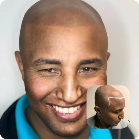 Scalp treatment before and after