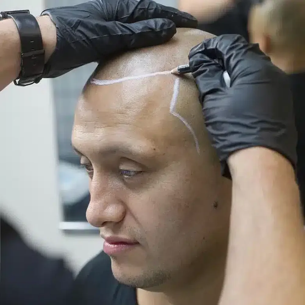 Steven Little mapping a client's new hairline before scalp micropigmentation